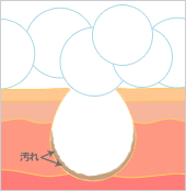Ishihara Awa Foaming Net