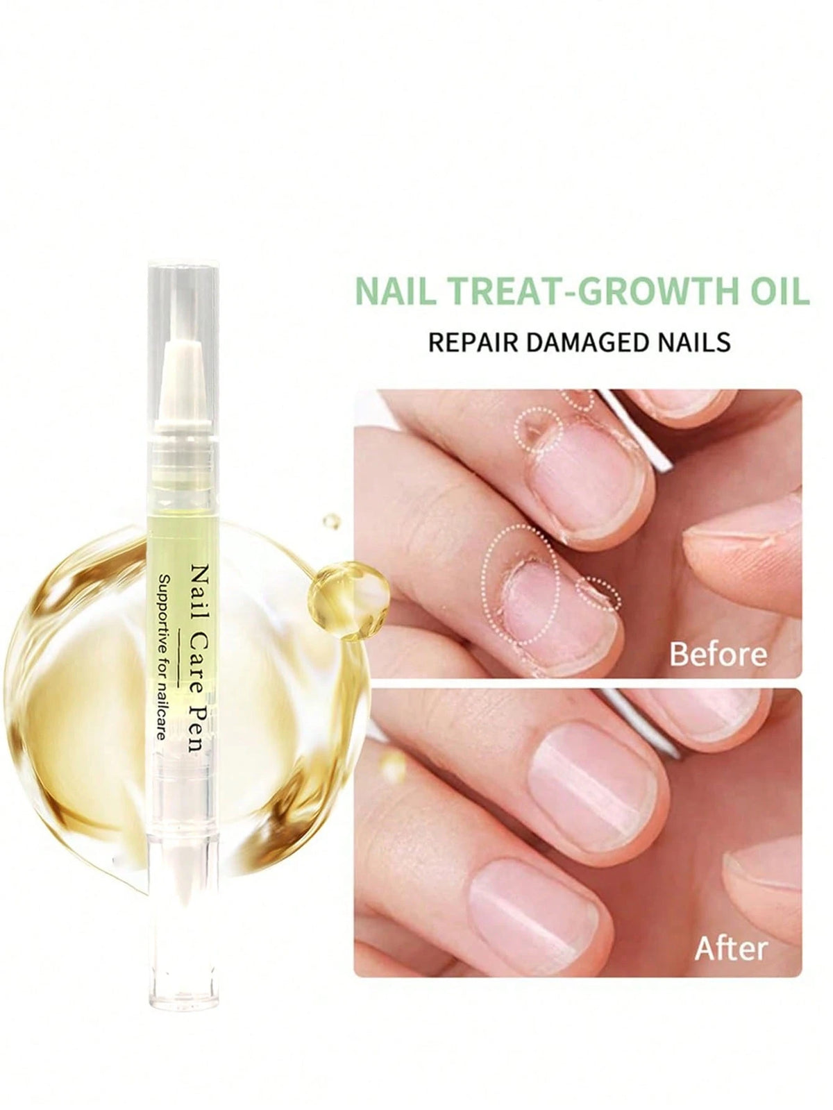 1/2Pcs Brother Cosmetics Nail Growth Oil| Nail Repair & Recovery Special| Hand & Nail Care Oil| Strengthens Nails & Boosts Growth| Nourishes Cuticles & Prevents Hangnails| Can Be Used With Nail P