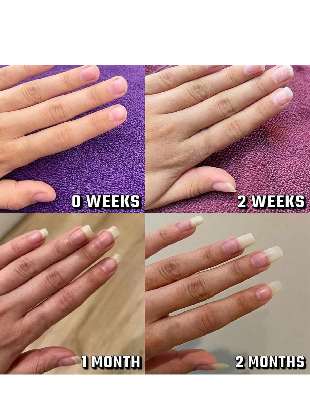 1/2Pcs Brother Cosmetics Nail Growth Oil| Nail Repair & Recovery Special| Hand & Nail Care Oil| Strengthens Nails & Boosts Growth| Nourishes Cuticles & Prevents Hangnails| Can Be Used With Nail P
