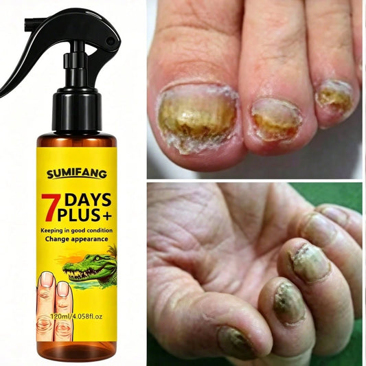 120ml 7-Day Nail Repair Serum, Repairs Brittle Nails, Prevents Breakage, Provides Nutrition, Restores Healthy Nail Quality, Recovers Healthy Nail Quality Within 28 Days.
