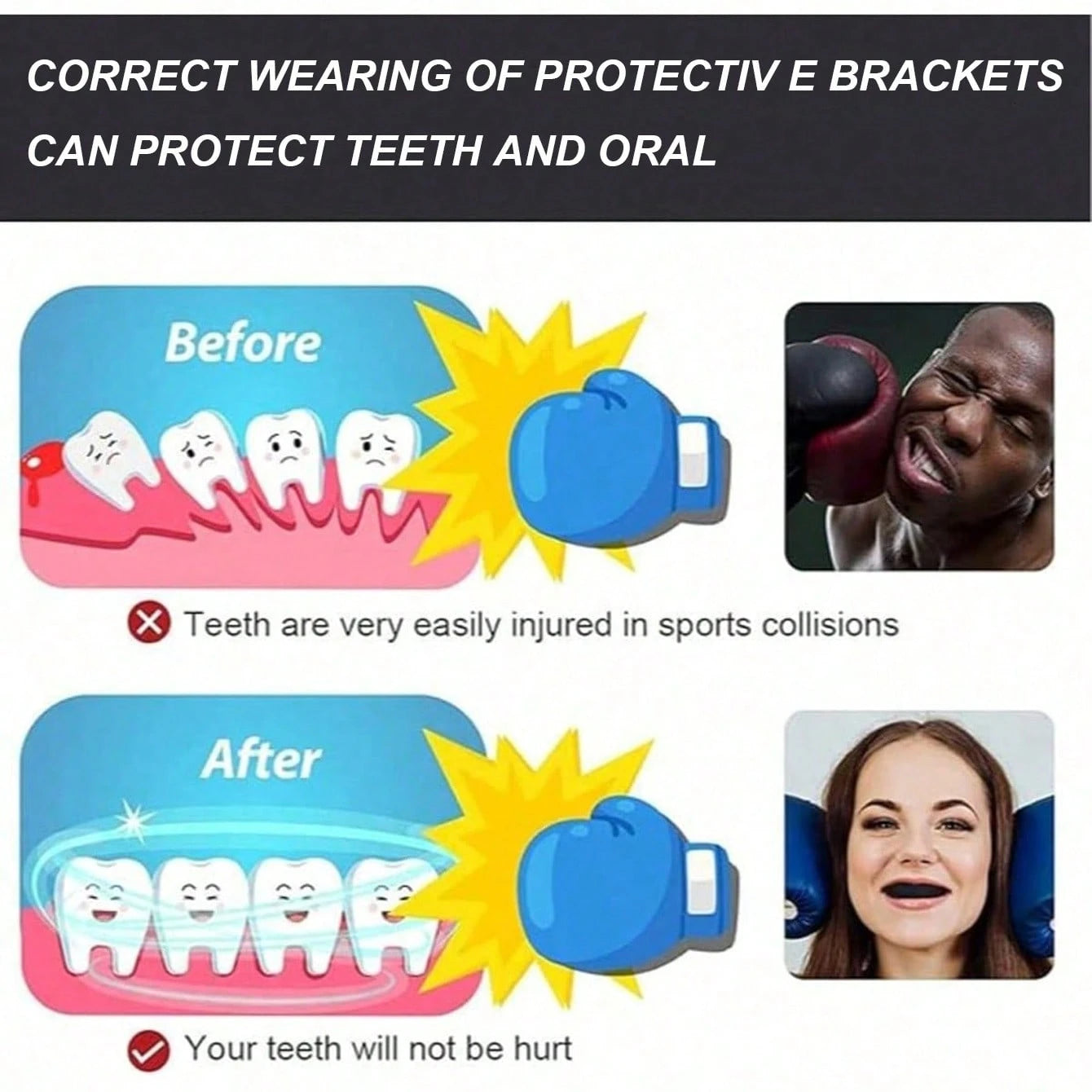 8pcs/4pcs/1pc Sports Mouth Guard With Storage Box, Boxing And Combat Mouth Guard, Wrestling Mouth Guard, Mouth Guard Also Suitable For Various Ball Sports