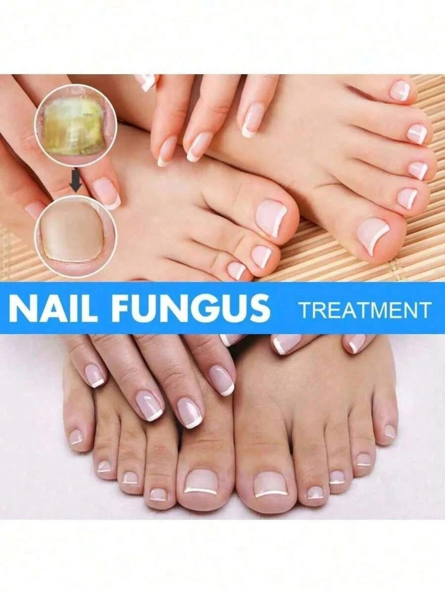 Nail Fungus Treatment Essence Cream Antifungal Gel Anti Infection Onychomycosis Paronychia Nursing